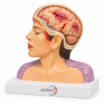 Laceration of Brain Model